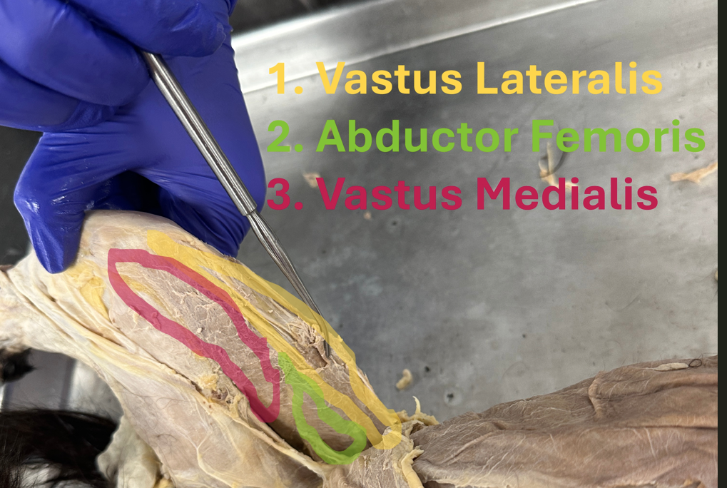 <p>Vastus lateralis (hindlimb superficial or deep muscle)</p>