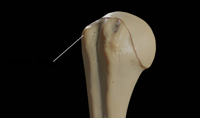<p>Humerus</p>