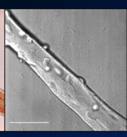 why does muscle fibre look this this?