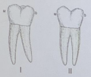 <p>This is a lingual view of mandibular molars. Which is a mandibular 1st molar?</p>