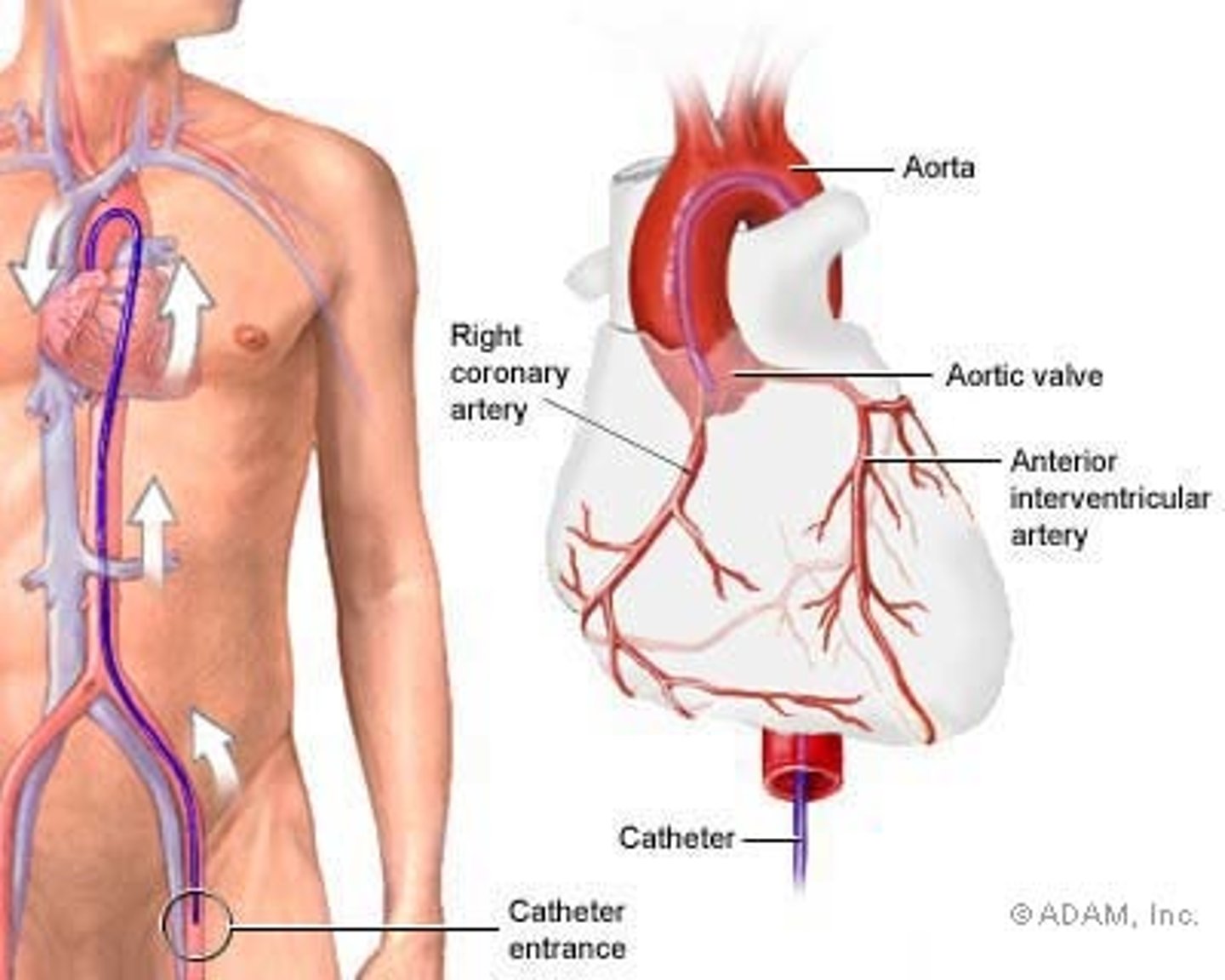<p>process of recording (x-ray) arteries after injecting contrast material</p>