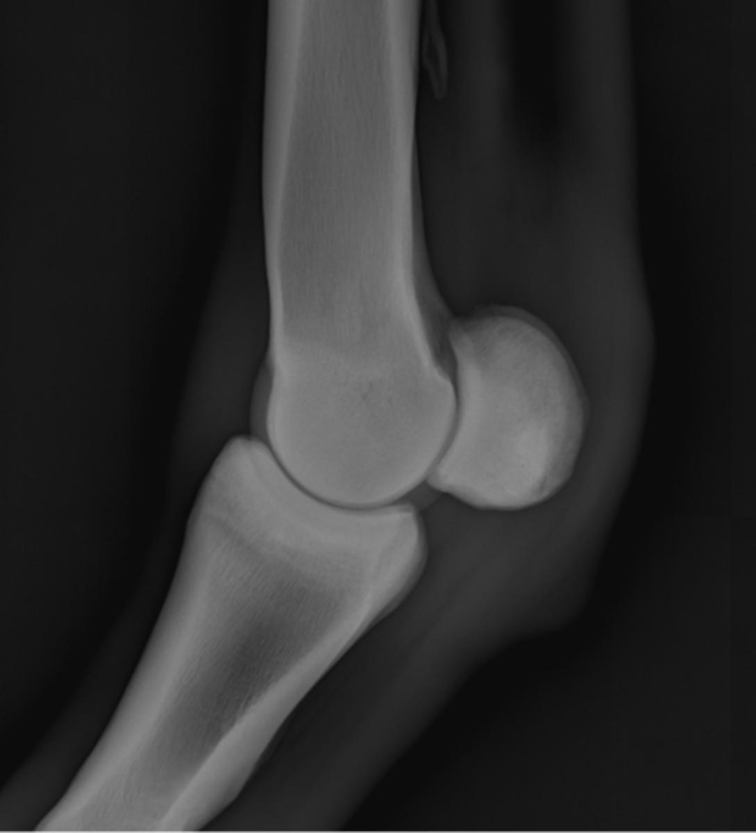 <p>ID joint and view</p>