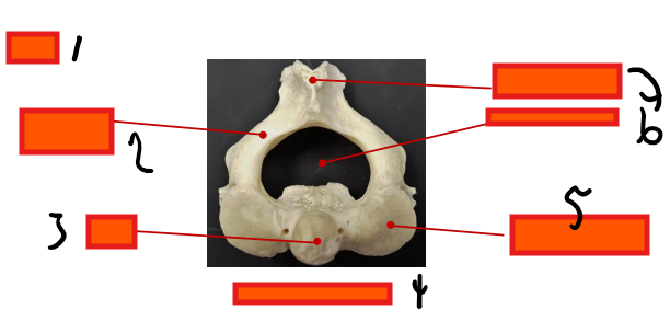 <p>Where is the spinous process</p>