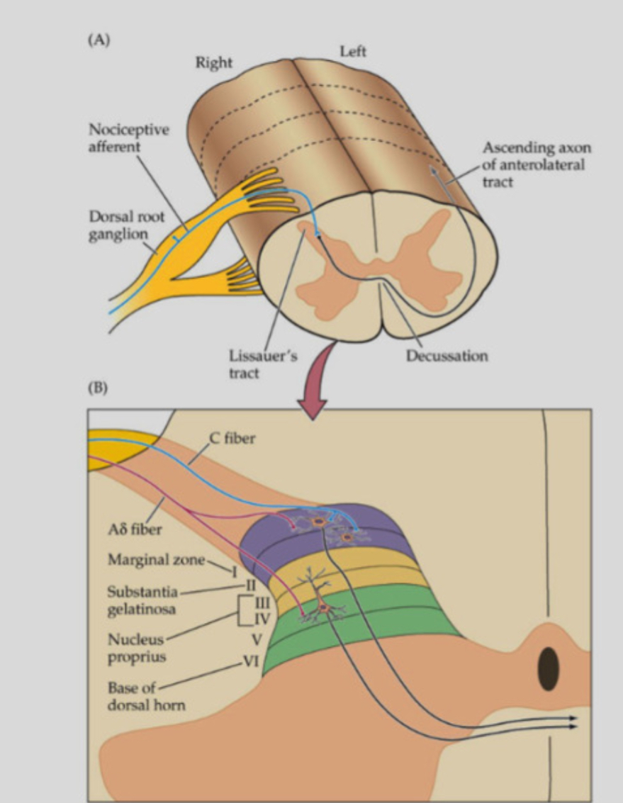 <p><span>•	Originates from dorsal horn interneurons receiving A-delta and C-fibre input.</span></p><p class="p1"><span>•	Axons cross in the spinal cord and ascend in the anterolateral white matter.</span></p><p class="p1"><span>•	Some STT neurons are multimodal, receiving both nociceptive and non-nociceptive input.</span></p><p class="p1"><span>•	Some receive visceral afferents, contributing to referred pain.</span></p>