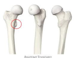 <p>projection on the medial and proximal side of the femur</p>