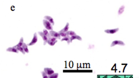 <p>Name: Toxoplasma gondii</p><p class="p1">Stage: tachyzoites</p><p class="p1">*banana-shaped, clustered, single central nucleus</p><p class="p1">*rapidly dividing stage (acute infection)</p><p></p>