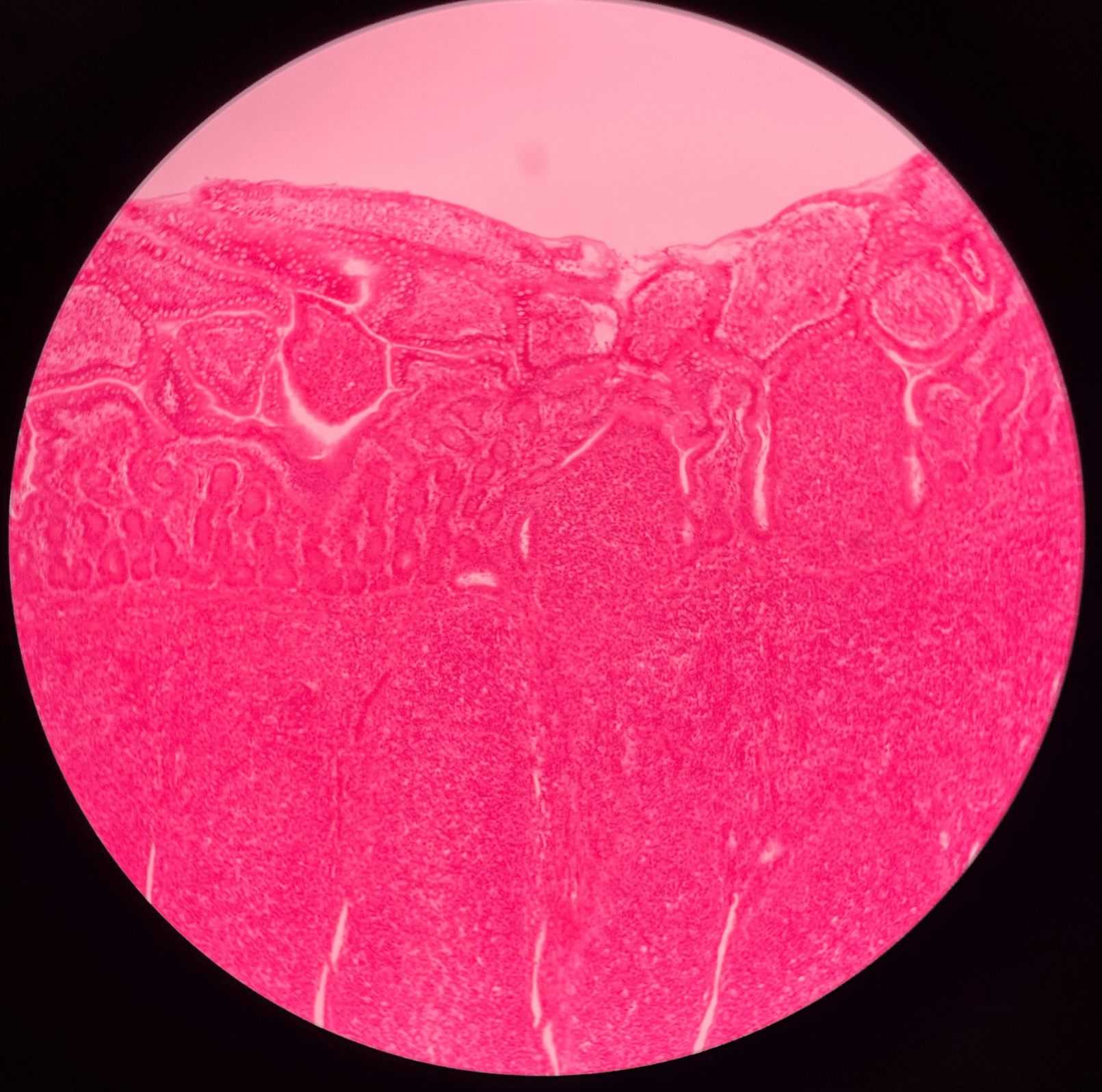 • Slide histology.

• The distal region of the small intestine.