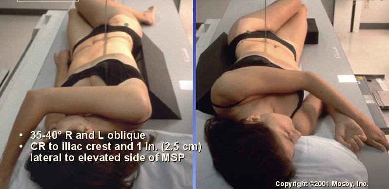 <p>What position is this?</p>