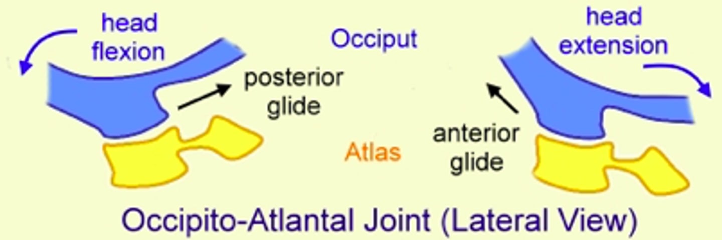 <p>convex occiput with concave C1</p>