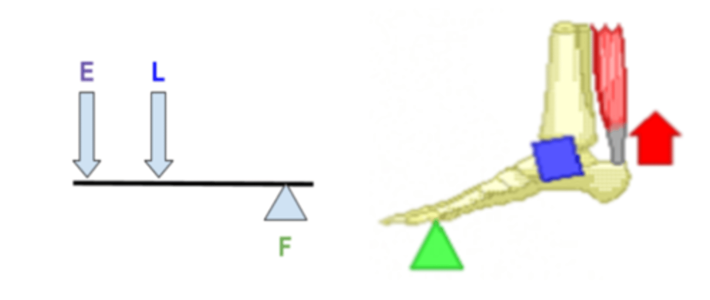 <p>Second-class levers (it has the load between the effort and the fulcrum) (e.g. contractions in the calf muscle pull the on the heel making the foot rise)</p>