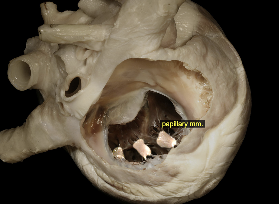 <p>Papillary muscles</p>