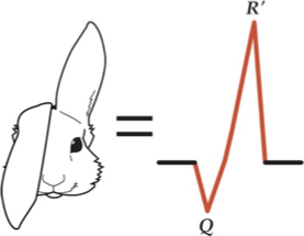 <p>in lead 1 and lead 2</p>