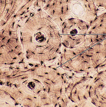 <p>what is the connective tissue?</p>