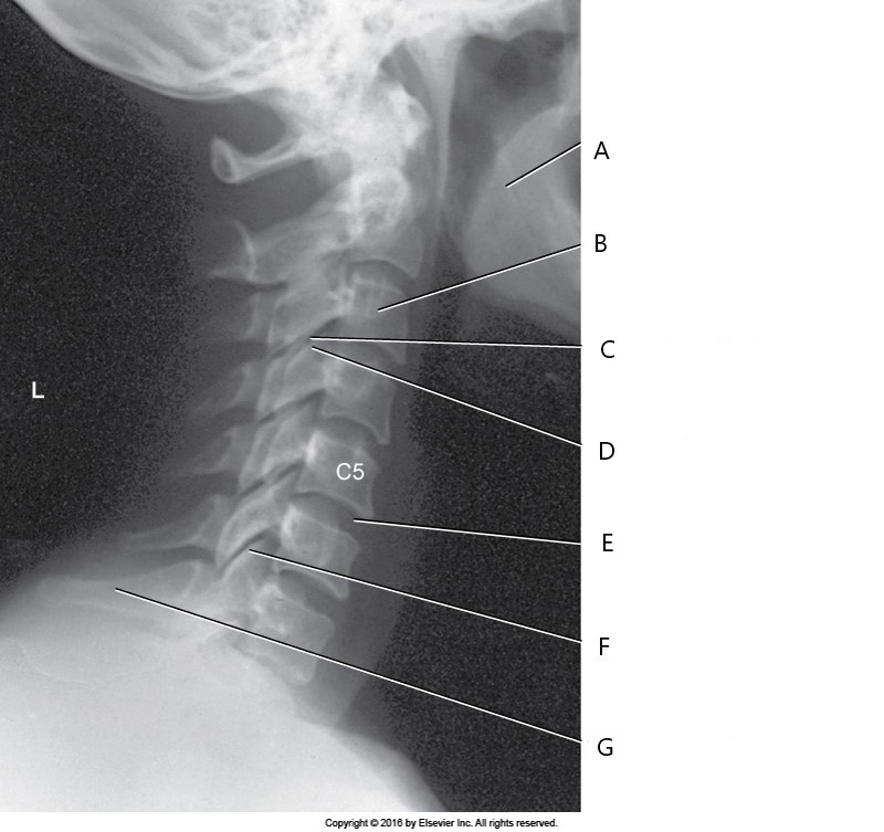 <p><span>The structure labeled F is:</span></p>