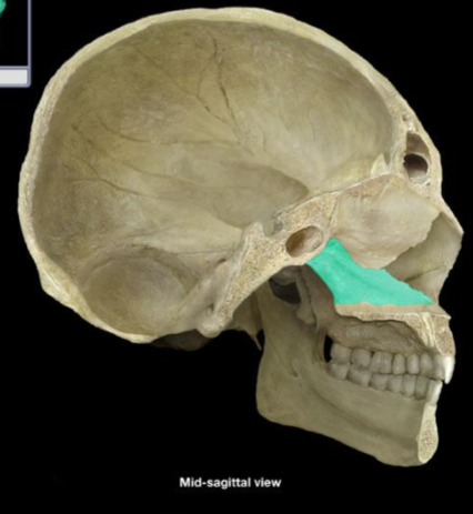 <p>What bone is this?</p>