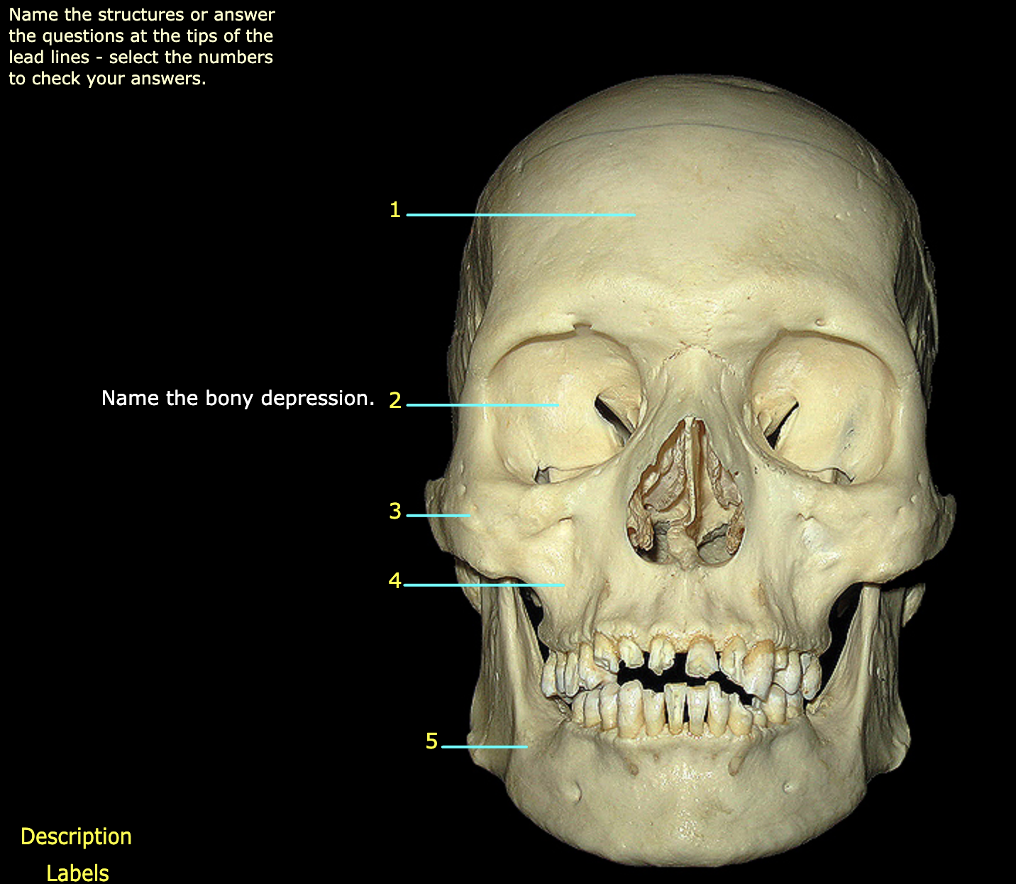 What structure is labeled 1?