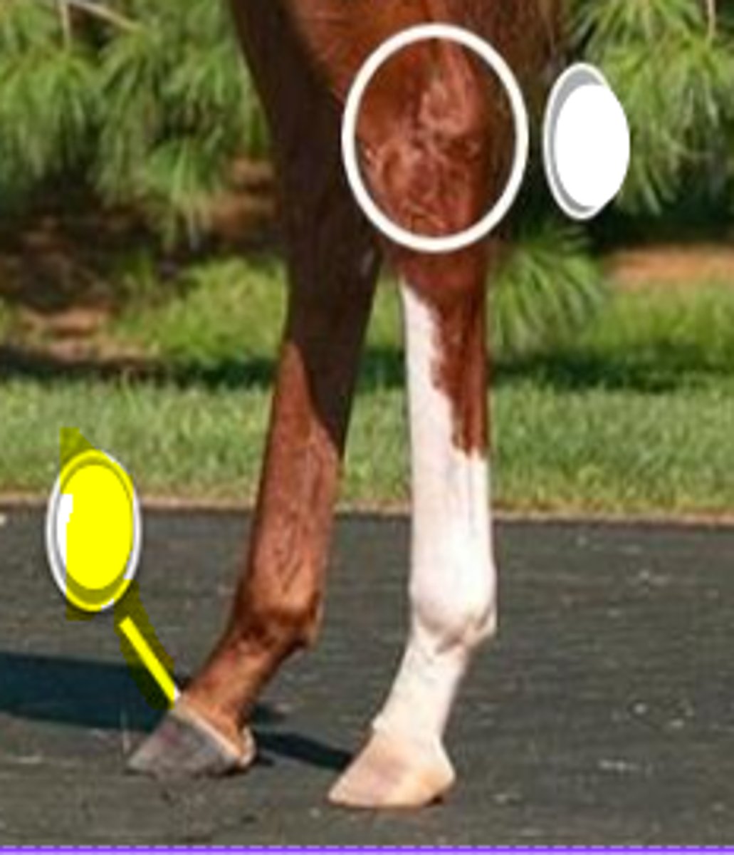 <p>What is body part is indicated on the image</p>