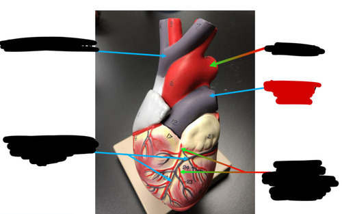 <p>Name this heart vessel</p>