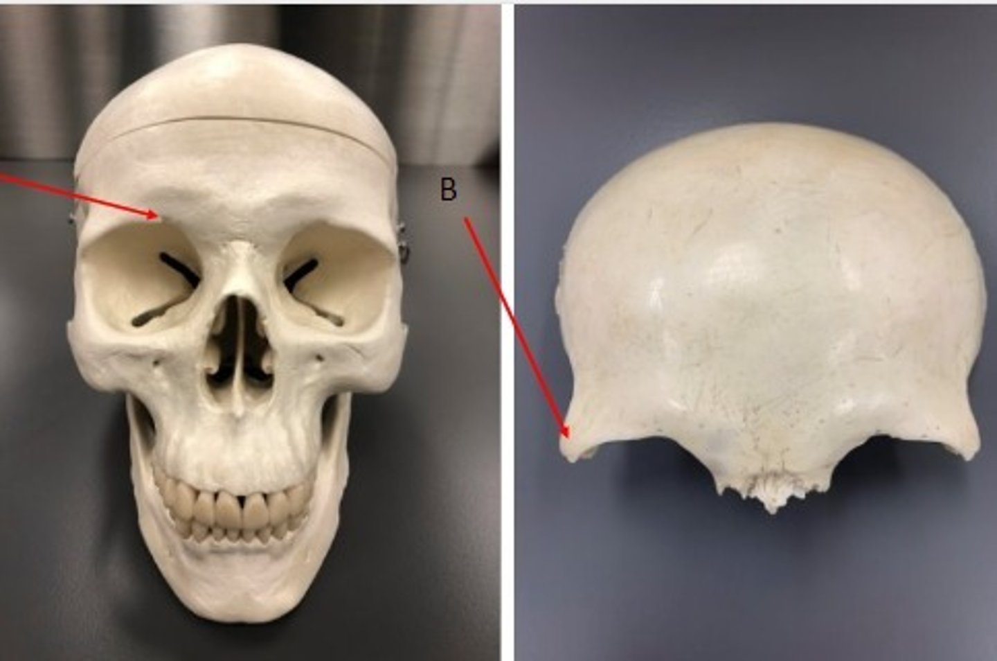 <p>What category of bone is it? What bone is it? Label the structures.</p>