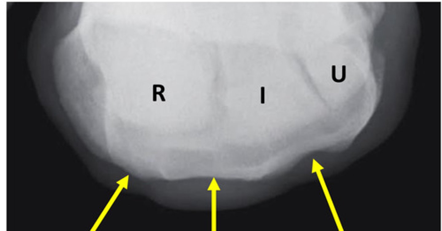 <p>What is the left arrow pointing to?</p>