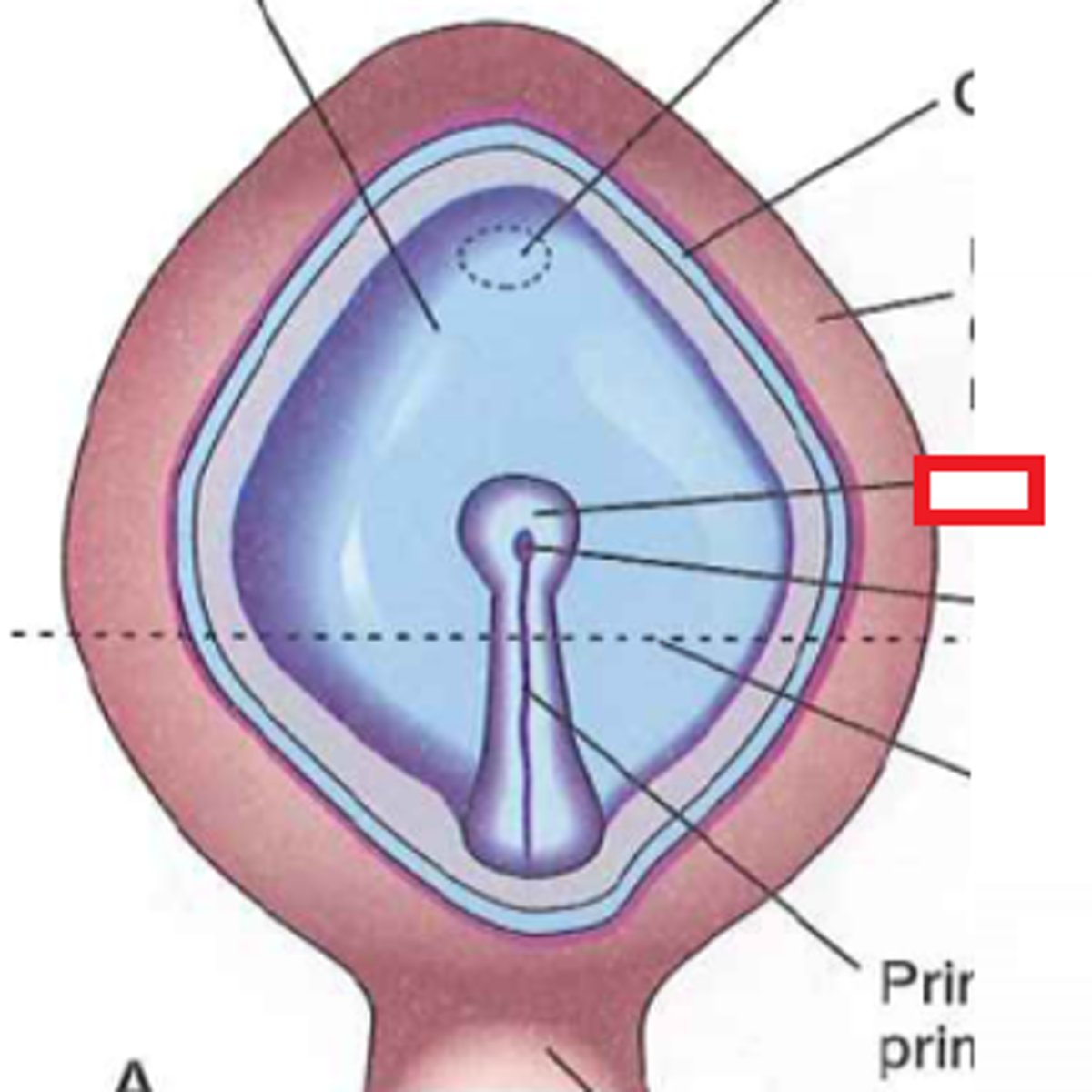 <p>Depression in primitive node</p>