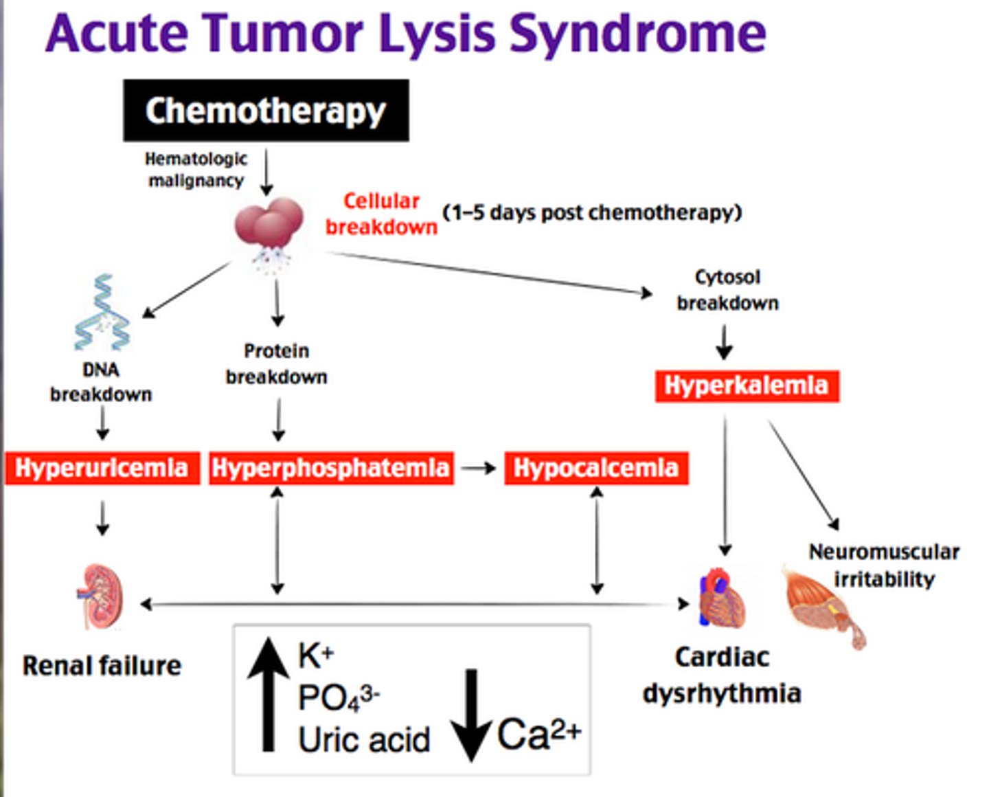 <p>← Acute tubular obstruction</p><p>- ↓ urine output</p><p>- ↑↑ uric acid</p><p>- Lympho or myeloproliferative disorders</p><p>- oliguric Renal failure</p><p>- acute Urate nephropathy</p>