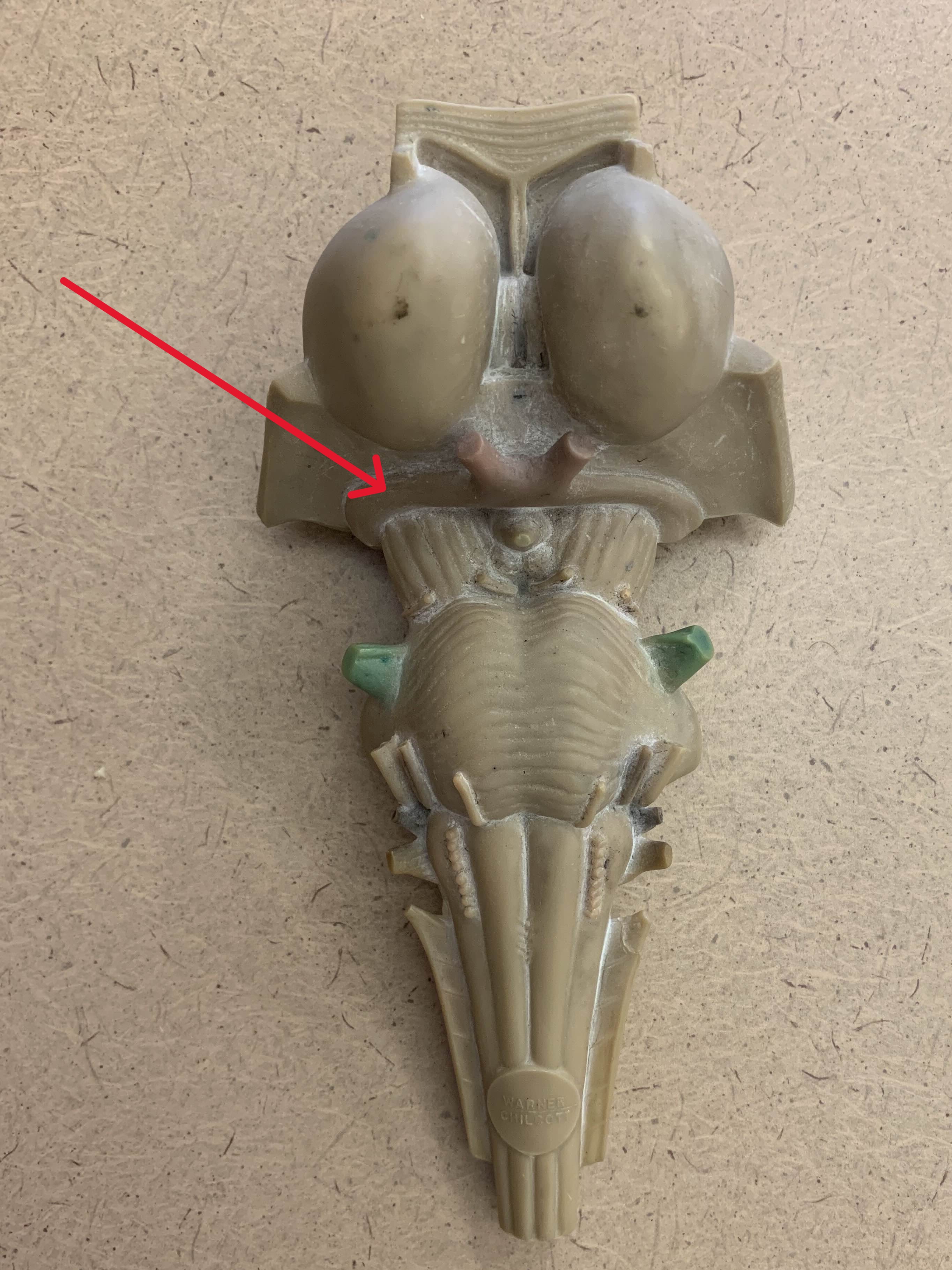 <p>Which nerve of the brain is:</p><ul><li><p>Inferior to thalamus</p></li><li><p>Superior to infundibulum</p></li></ul><p></p>