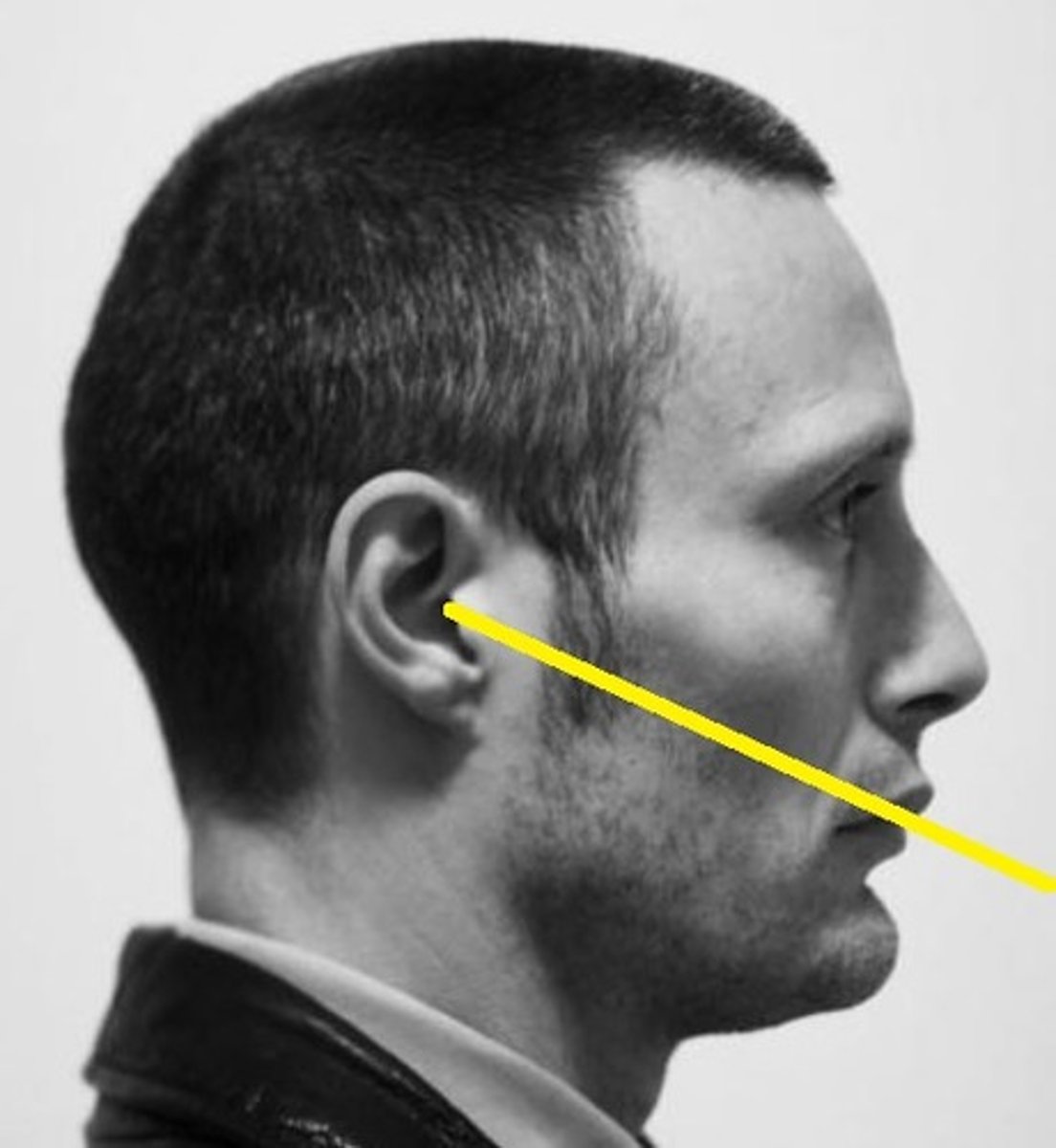 <p>Lips-meatal line</p>