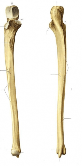 <p>ulna</p>