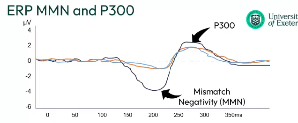 <p>Event related potential - repeated peaks in EEG signals during a task</p>