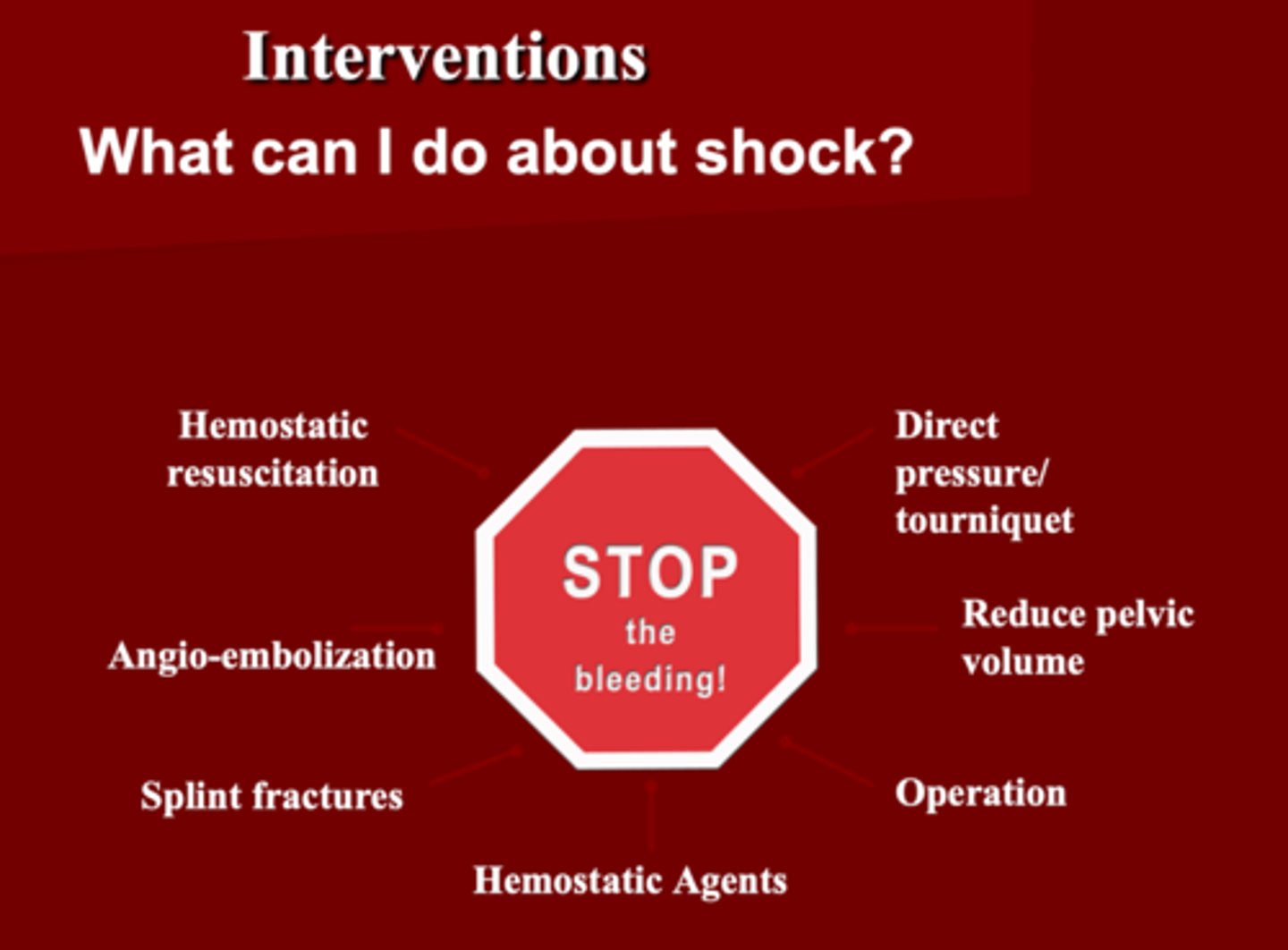 <p>STOP THE BLEEDING </p><p>1. Hemostatic Resuscitation (fluid challenge based on</p><p>2. Direct pressure/tourniquet </p><p>3. Angio-embolization ***</p><p>4. Reduce pelvic volume </p><p>5. Hemostatic agents </p><p>6. Operation </p><p>7. Splint fractures </p>