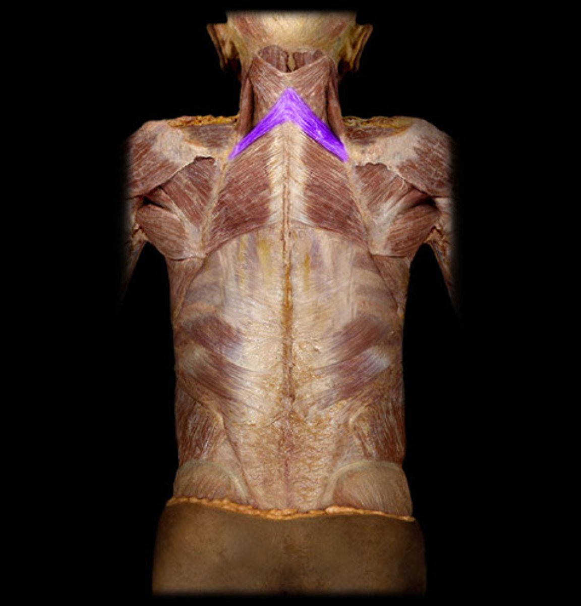 <p>Actions: Retracts scapula</p><p>Origin: Spinous process C7-T1 vertebrae</p><p>Insertion: Medial boarder of scapula</p><p>Innervation: Dorsal scapular nerve</p>