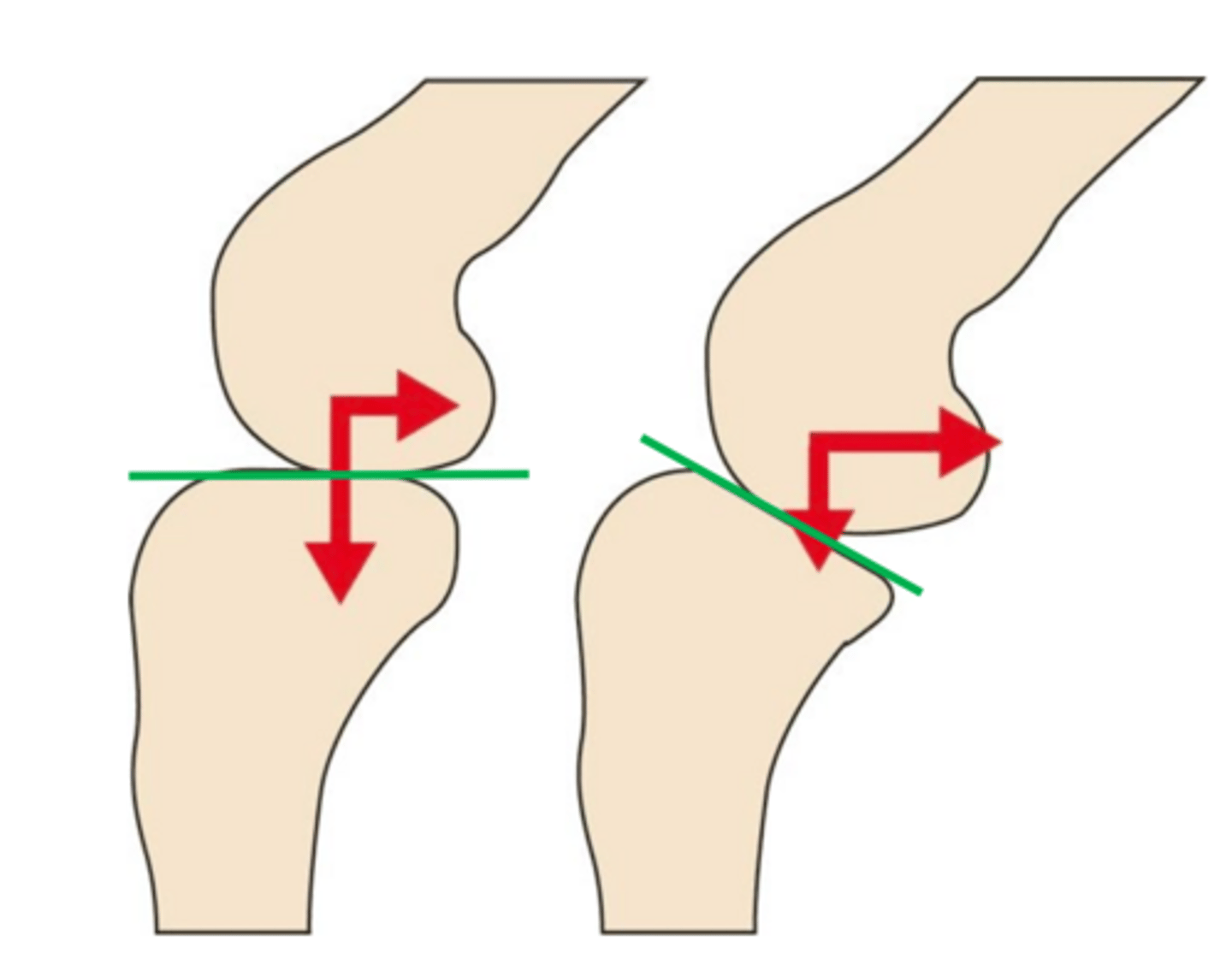 <p>CCL functions as a _____ ____ to cranial tibial translation and internal rotation of tibia</p>