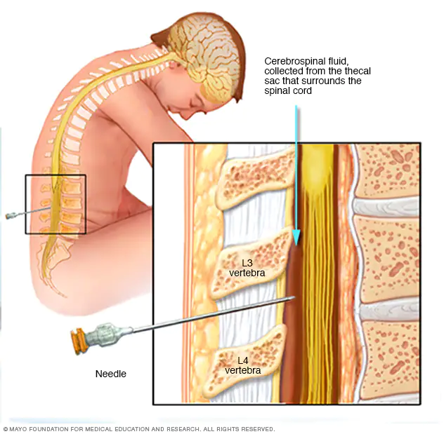 procedure used to withdraw CSF from the lower lumbar region of the vertebral column that avoids the risk of damaging CNS tissue because the spinal cord ends at the upper lumbar vertebrae