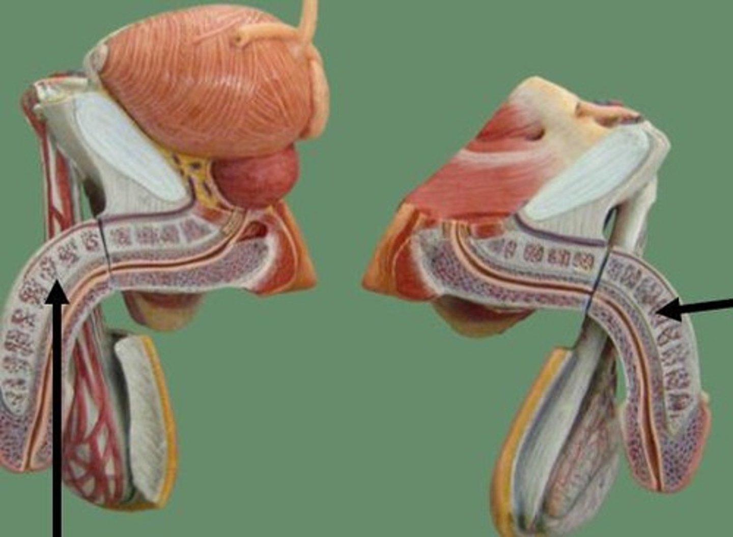 <p>What part of the male reproductive system is this?</p>