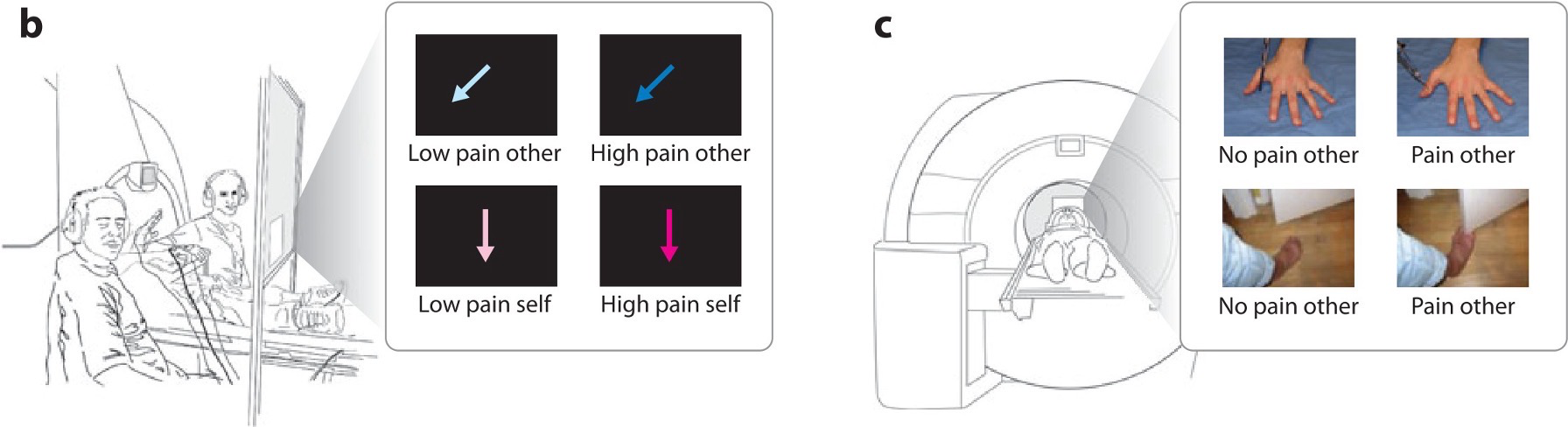 <p>cue based stimuli vs picture based stimuli </p><ul><li><p><span><span>primary somatosensory cortex (SI) responses to others’ pain was greater for bodily-related stimuli (relative to over non-bodily-related stimuli)</span></span></p><ul><li><p><span><span>Need to compare cues to know whether a picture changes how you experience pain compared to just a cue</span></span></p></li></ul></li></ul><p></p>