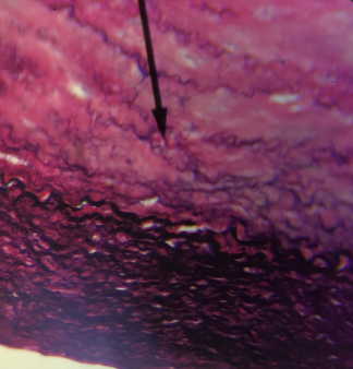 <p>what kind of tissue is this </p>