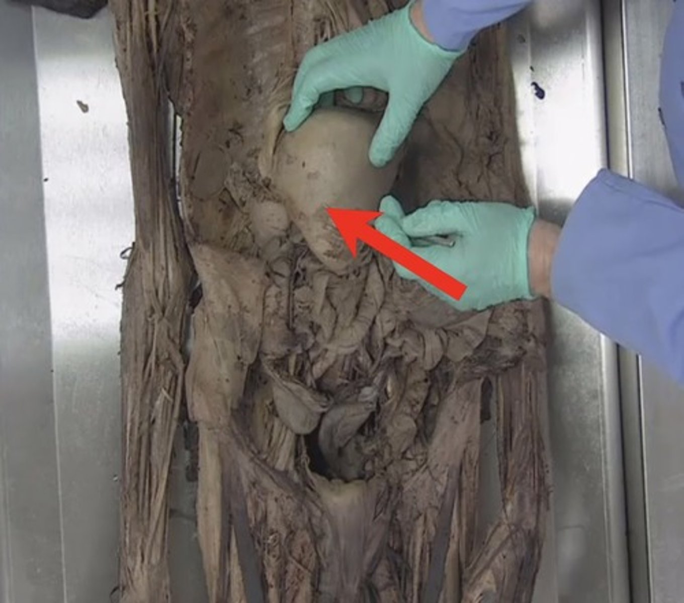 <p>(if they pull something up from liver)</p>