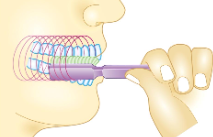 <p><span><strong>• Used mainly by young children</strong></span></p><p><span><strong>• Teeth are clenched, brush is placed inside cheeks</strong></span></p><p><span><strong>• Brush moved in circular motions</strong></span></p><p><span><strong>• Can be damaging if done too vigorously</strong></span></p>