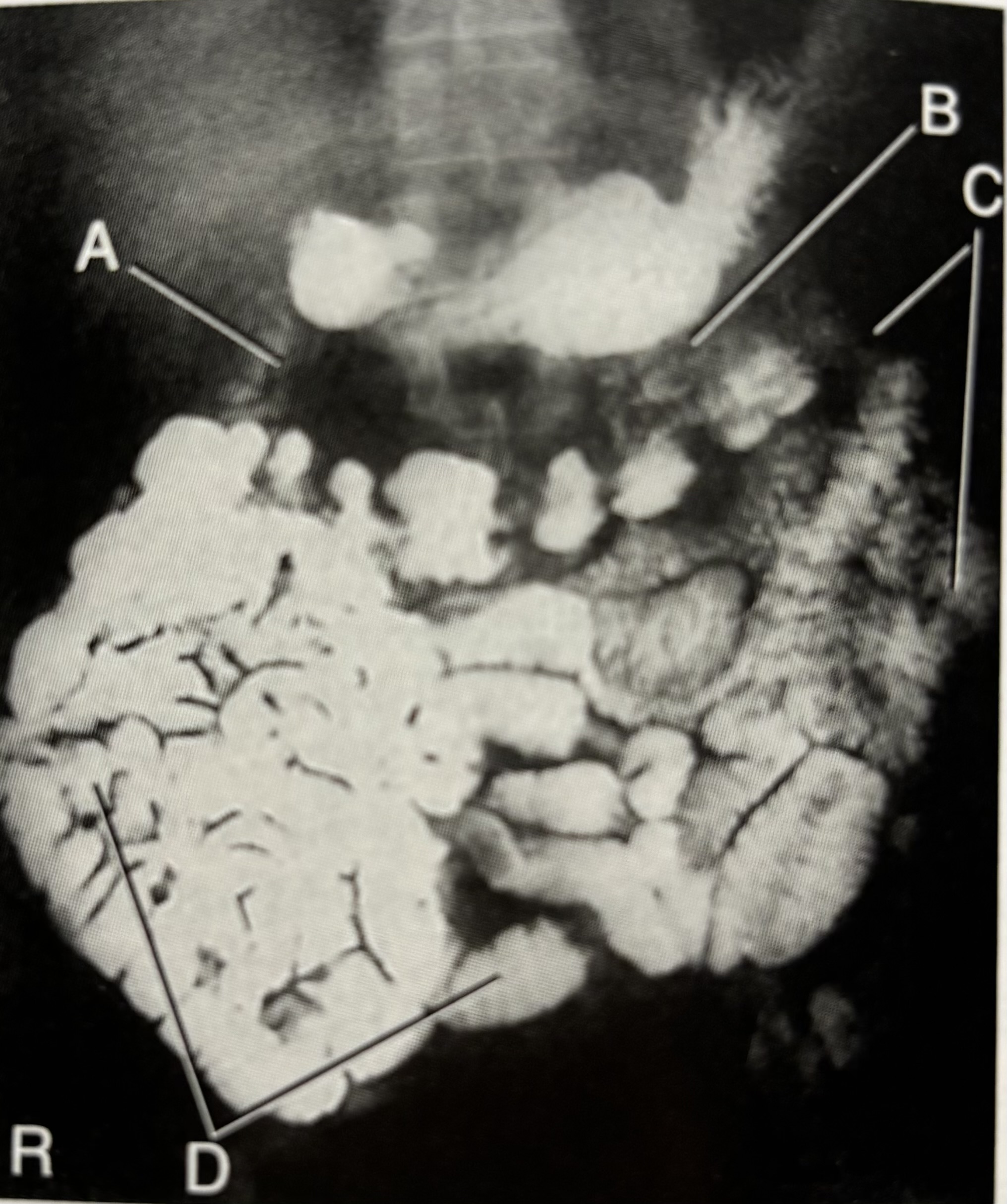 <p>What is B pointing to?</p>