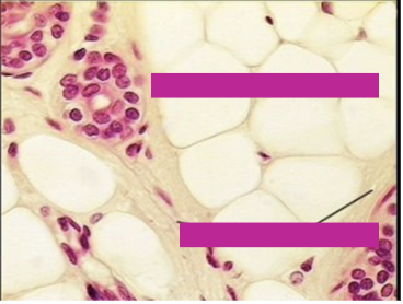 <p>Found of the basement membrane of epididymus</p>