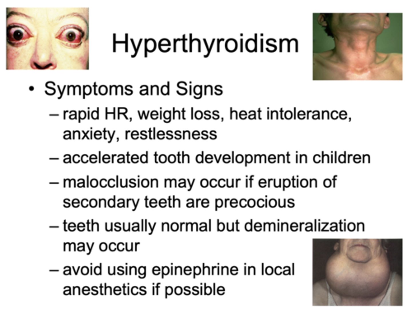 <p>hyperthyroidism</p>