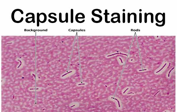 <p>Capsule: an envelope having a gelatinous consistency Procedure for visualizing the bacterial capsule- India ink (negative stain) THE BACKGROUND IS STAINED BUT NOT THE CELL</p>