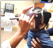 <ul><li><p>room/tool readiness </p><ul><li><p>sharpie, tape measure, ML stick, distraction devices, etc. </p></li></ul></li><li><p>patient positioning </p><ul><li><p>on parent’s lap, faced outward, extended out to knee, holding infant’s torso</p></li></ul></li><li><p>position the orthosis </p><ul><li><p>kneel in front of patient </p></li><li><p>spread opening from plastic as wide as possible (never Velcro/chafe)</p></li><li><p>center the CRO on infant’s head using the midline of the forehead as a guide </p></li><li><p>do not secure Velcro strap </p></li></ul></li><li><p>assess and mark initial trim lines</p></li></ul><p></p>