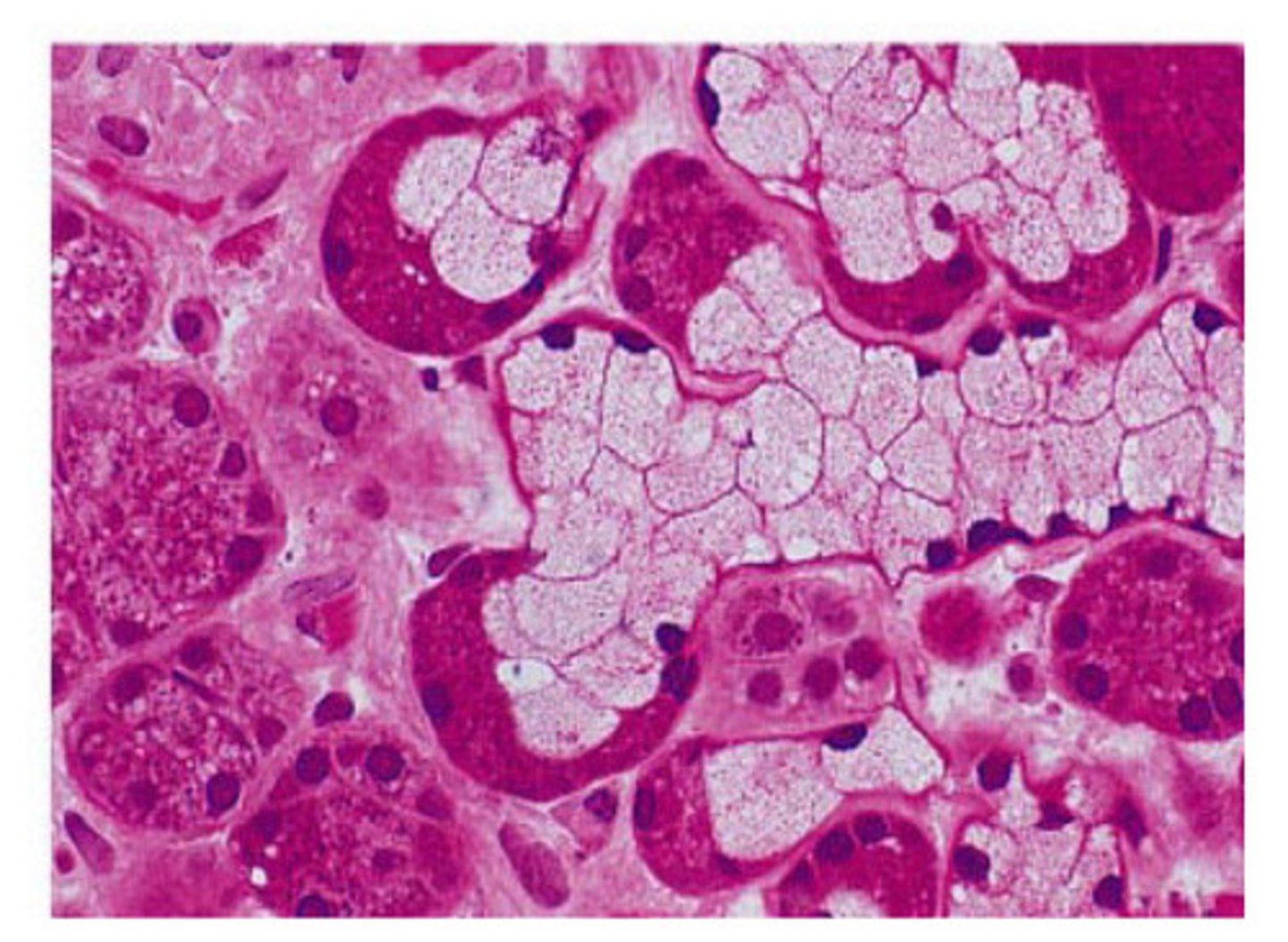 <p>Salivary gland</p>