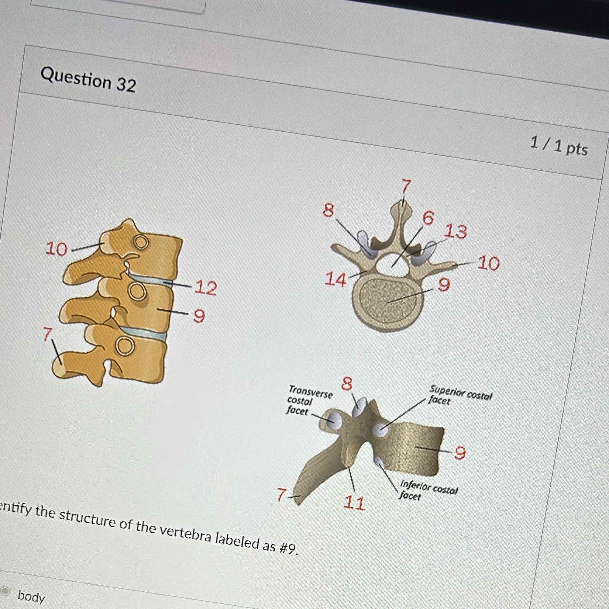 <p>Identify the structure of the vertebrae labeled as 9</p>