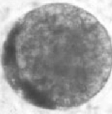 <p>Grade that embryo!</p><p></p><p>I have few extruded blastomeres, irregular shape, and slight separation of my trophoblast</p>