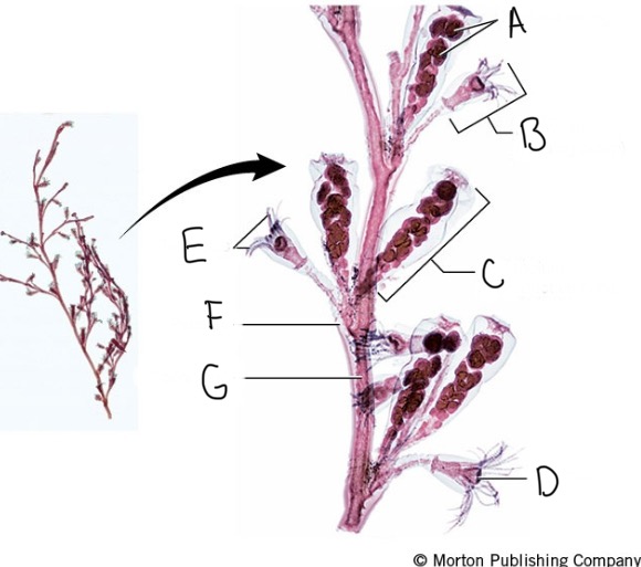 <p>What organism is this? Phyla and class? Name the parts labelled below corresponding to each part.</p>