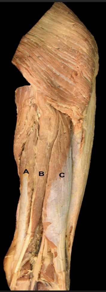 <p>Identify the muscles of the <strong>Posterior Thigh’s Hamstrings </strong></p>