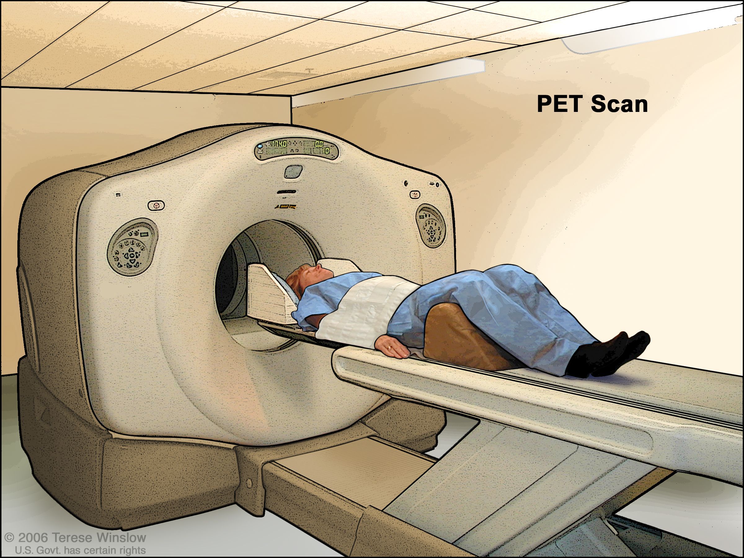 <p><strong> PET scan?</strong></p>